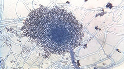 Every day we live is a blessing from those microscopic warriors that fight battles against harmful infiltrators that tries to enter our body.
(CDC PHIL)