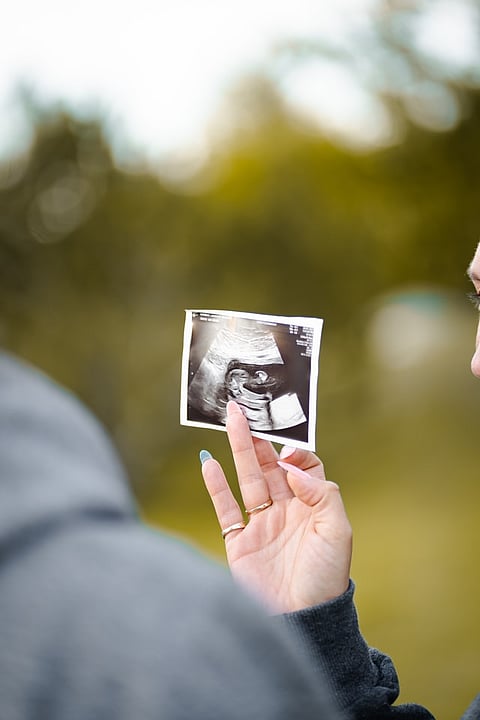 Stamp-sized ultrasound stickers that can monitor foetuses in womb (representational image - Unsplash)