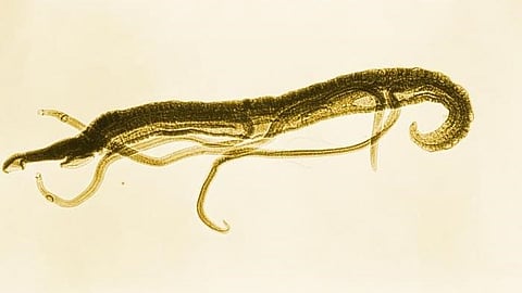 Not only Slugs, snails cause rat lungworm disease in humans  (CDC PHIL)