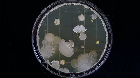 Western diet and gut bacteria can lead to scarring in scleroderma (Unsplash)