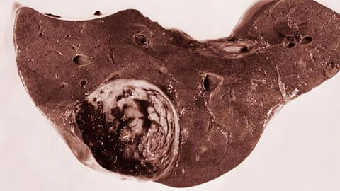 Inhibition of cancer growth using compounds that protect plants (CDC PHIL)