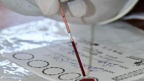 UP jails vulnerable to HIV spread (CDC PHIL)