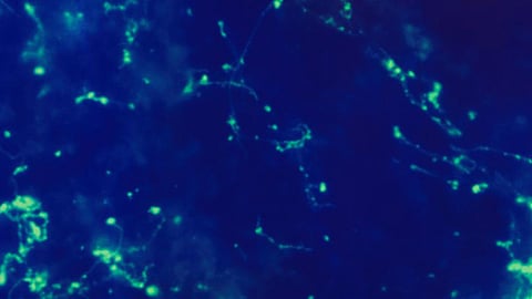 Understanding the race against time when battling pathogens inside our body. (CDC PHIL)