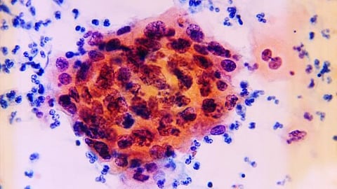 Schwann cells are known to protect and repair nerve cells. Until now, however, it was not known that they themselves take over functions of certain immune cells during nerve healing (CDC)