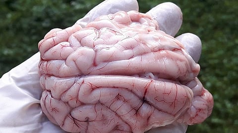 The human brain is probably the most complex organ in the entire living world and has long been an object of fascination for researchers. However, studying the brain, and especially the genes and molecular switches that regulate and direct its development, is no easy task (Wikimedia)