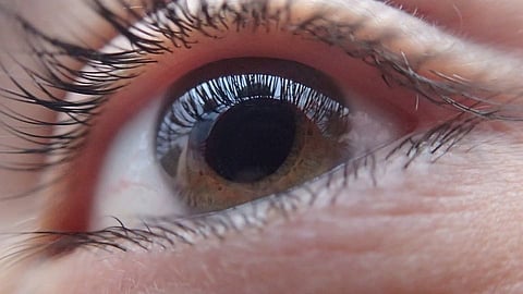 Trichomegaly is a rare disorder where the normal features of the eyelashes such as length, colour, thickness, or curling alter. (Representational image: Pixabay)
