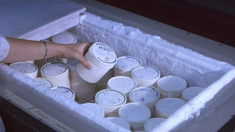 The first person to be cryogenically frozen was James Bedford. He was an American businessman from Maine. (IMAGE: CDC PHIL)