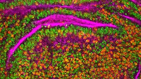 Stable and bright fluorescent protein moxSAASoti, that can change color and intensity of its fluorescence. (unsplash)
