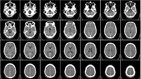 The database, called neuromaps, will help scientists find correlations between patterns across different brain regions, spatial scales, modalities and brain functions (Wikimedia commons)