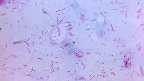 Leprosy is one of the world’s oldest and most persistent diseases but the bacteria that cause it may also have the surprising ability to grow and regenerate a vital organ. (Representational Image: CDC PHIL)