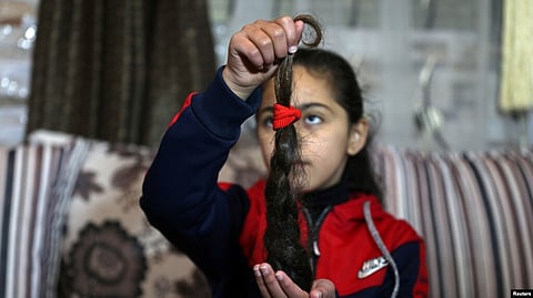 According to WHO, Cancer is a leading cause of death worldwide, accounting for nearly 10 million deaths in 2020. The most prevalent cancers include prostate, breast, lung, colon, and rectum.