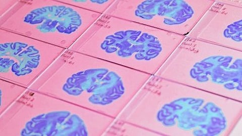 Tissue samples stained to reveal different features of the brain. The BICAN project aims to map the brain in unprecedented detail at the single cell level in 3D(Newswise)