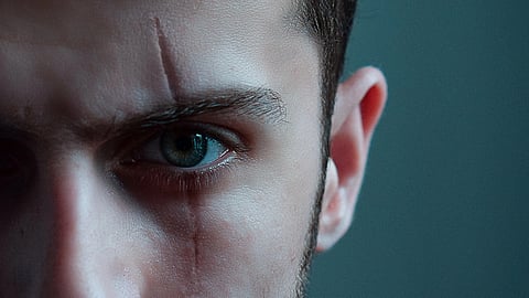 Faces with scars located at the mid-lower eyelid were rated lower for attractiveness, confidence, and friendliness but only if oriented perpendicular to facial tension lines. (Image: Unsplash)