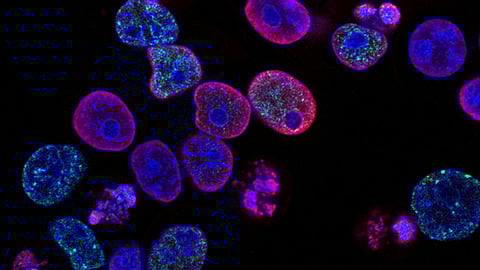 A normal process called cell competition, in which healthy tissues eliminate unhealthy cells, could be responsible for cancer relapses in patients months or years after they were declared cancer-free, a new study by UT Southwestern Simmons Cancer Center researchers suggests.(Image : Unsplash)