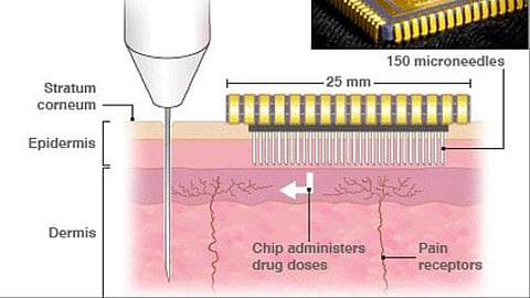 Microneedles Drug Patch