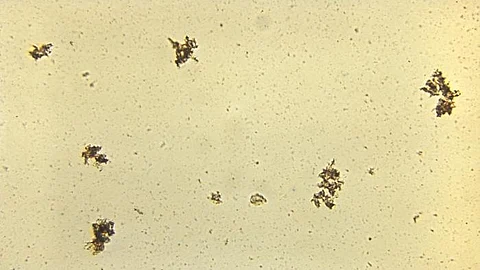 A recent study by a team comprising researchers revealed that low levels of ergothioneine (ET) in blood plasma may predict an increased risk of cognitive impairment and dementia.