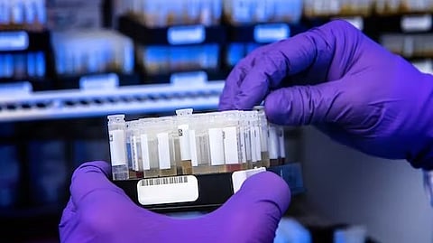 Antibody invented at Charlotte shows promise for pancreatic cancer treatment (Unsplash)