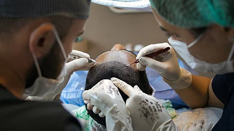 In a shocking incident, a 30-year-old man died due to alleged medical negligence after undergoing hair transplant at a clinic in Delhi.