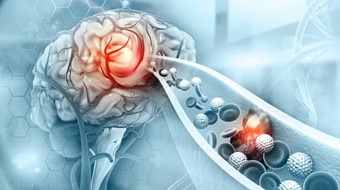 Fluid intelligence is thought to be a key feature involved in “active thinking” - a set of complex mental processes such as those involved in abstraction, judgment, attention, strategy generation and inhibition.