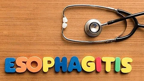 Eosinophilic esophagitis (EoE) is an allergic condition of the esophagus that is on the rise throughout the United States. (Unsplash)