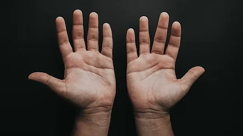 Palm E-tattoo can Tell When You’re Stressed out (Unsplash)