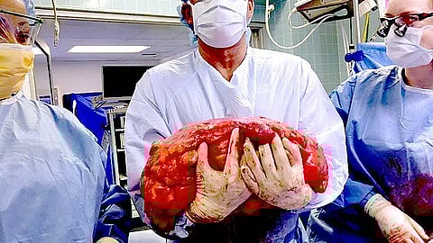 A multi-disciplinary team has been assisting gastrointestinal cancer physicians – reviewing test results and offering timely recommendations on treatment options. (WIKIMEDIA COMMONS)