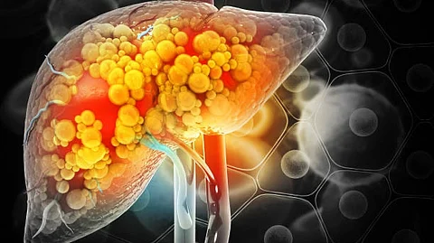 Although rare compared to adult liver cancers, hepatoblastoma is the most common pediatric liver malignancy, and its incidence is increasing (Unsplash)