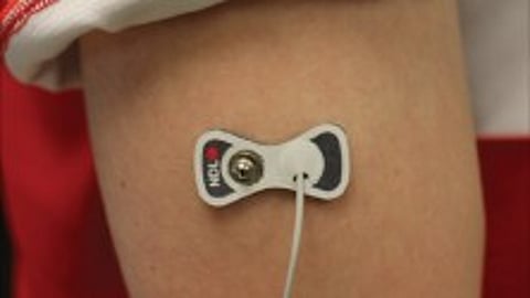 A prototype of a device that can measure interstitial fluid uses microneedles.