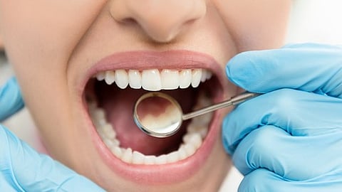 Early humans: Annual cycles in tooth enamel provide insights into life histories