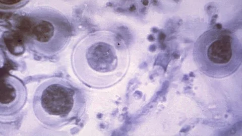 Eukaryotic cells are the ones that make up most life as we know it, including all animals, plants, and fungi. They are highly structured objects (CDC PHIL)