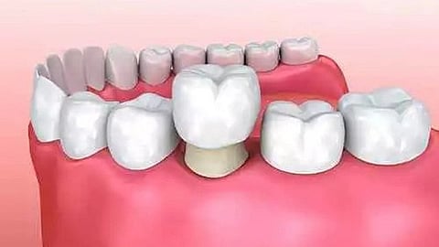 Let's embrace the beauty of differences, the reel vs. the real concept of the academic journey of dentistry!(WIKIMEDIA COMMONS)