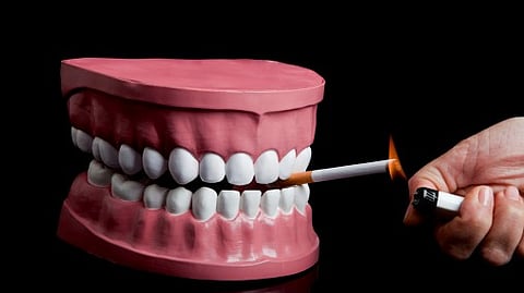 Treatment for severe periodontitis in heavy smokers is ineffective.