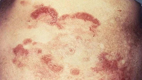 Every year, over one lakh people in India are diagnosed with some form of a blood cancer, making it one of the leading causes of cancer-related deaths among children.