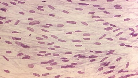 Collagen-induced gut cell reprogramming (CDCPHIL)