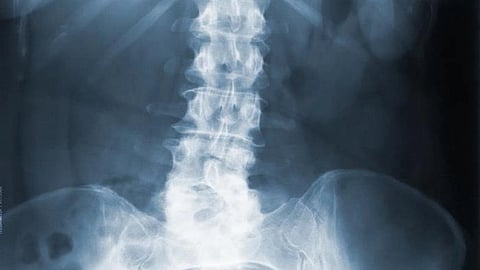 Orthopedic surgeons, long seen as fiercely independent, are rapidly catching up with other specialist physicians, such as dermatologists and ophthalmologists, in selling control of their practices to private equity investment firms.