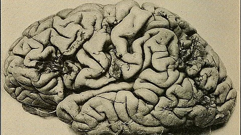 Animal studies have shown that increasing the availability of BDNF encourages the formation and storage of memories, enhances learning and overall boosts cognitive performance.
