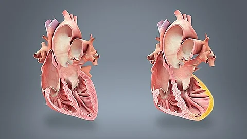 Smidt Heart Institute Cardiologists Explain More About MINOCA in Advance of American Heart Month.