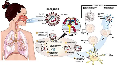 The different strains of the virus that emerged during the pandemic led to varying degrees of damage: especially involving pre-Omicron variants, the detected placental lesions could potentially harm both development and health in some of the affected unborn children.