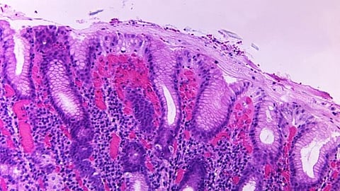 South Africa has recorded two confirmed imported cases of cholera, the health department said Sunday, as it called for vigilance.