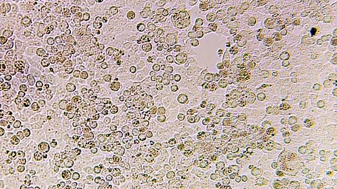 Adenovirus can spread through skin contacts, by air through coughing and sneezing and through an infected person's stool.