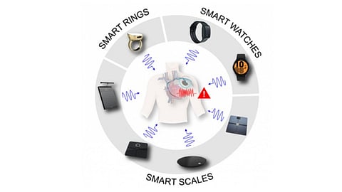 Certain fitness and wellness trackers could pose serious risks for people with cardiac implantable electronic devices (CIEDs) such as pacemakers, implantable cardioverter defibrillators (ICDs), and cardiac resynchronization therapy (CRT) devices.