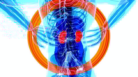 For men undergoing surgery to repair scarring in the urethra (urethroplasty), a new approach to pain management can reduce the need for strong opioid drugs without compromising pain control,