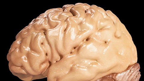 Epileptic seizures are caused by uncontrolled electrical activity originating in a specific part of the brain (focal epilepsy) or from broad areas across both sides of the brain simultaneously (generalized epilepsy).