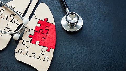 A clinical trial led by Upstate Medical University radiation oncologist Dr. Jeffrey Bogart may have major implications for the treatment of small-cell lung cancer.