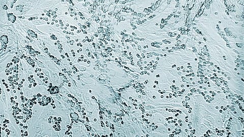 The compound proved effective in lung tissue preparations and mouse studies and showed synergistic effects with already approved influenza drugs.