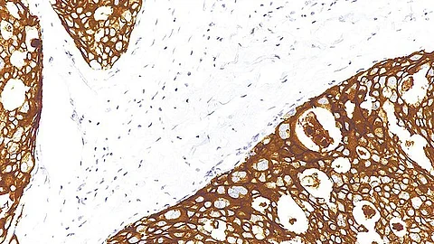 Androgens such as testosterone are involved primarily in the development of male traits, although females also produce androgens.
