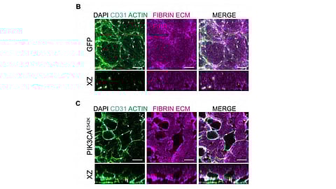 Representative confocal images of control and PIK3CAE542K vascular networks.