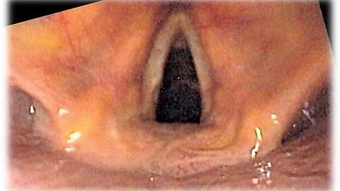 Females have higher larynxes and therefore shorter vocal tracts