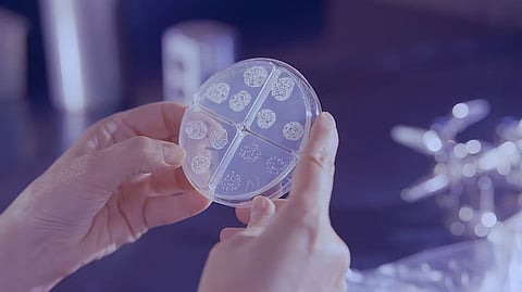 India has the highest disease burden globally with more than half a million tuberculosis deaths in 2021. This number amounts to about a third of the global total.