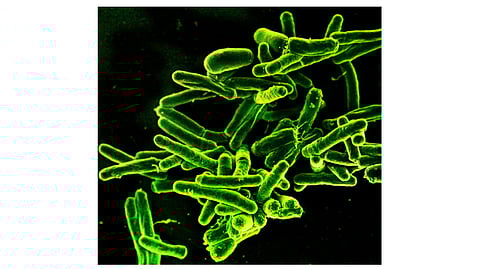 Scanning electron micrograph of Mycobacterium tuberculosis bacteria, which cause TB.